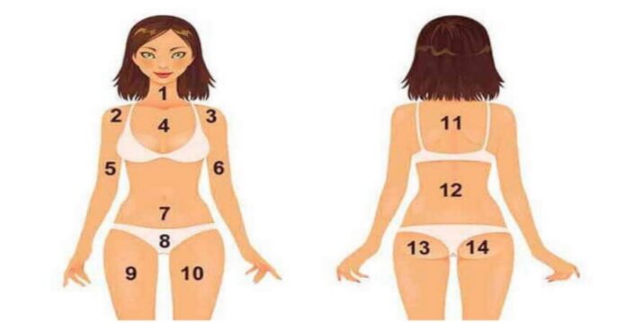 Akne karta eller VILKEN SLAGS problem avslöjar finnar i hakan, höfterna eller bröstet?